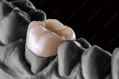 精密審美治療のイメージ画像