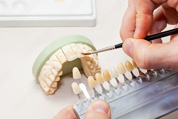 歯科技工のイメージ画像